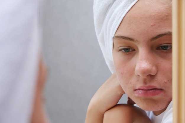 Атопический дерматит на лице у взрослых: причины и симптомы