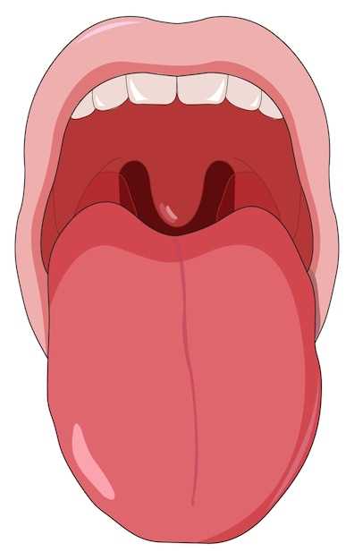 Изменения внешнего вида языка при инфекционных заболеваниях полости рта