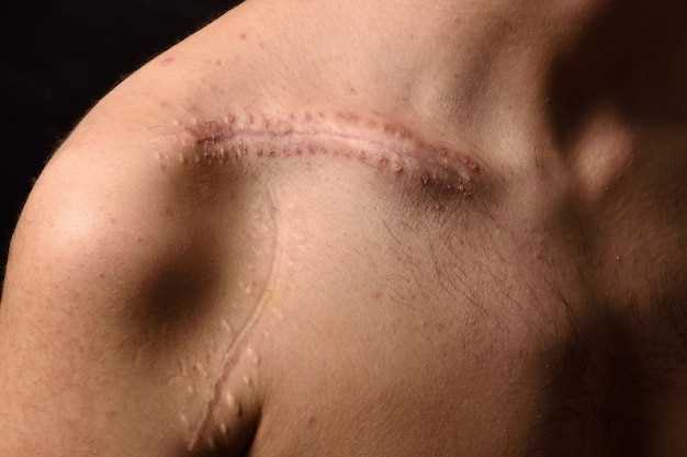 Поверхностные порезы, не проникающие в глубокие слои кожи