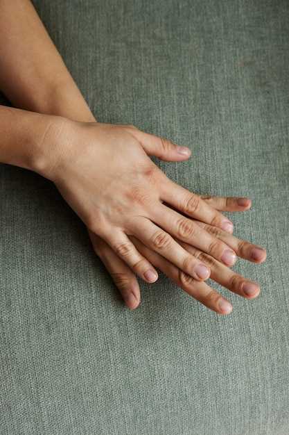 Причины отслоения верхних слоев ногтевой пластины и способы их предотвращения
